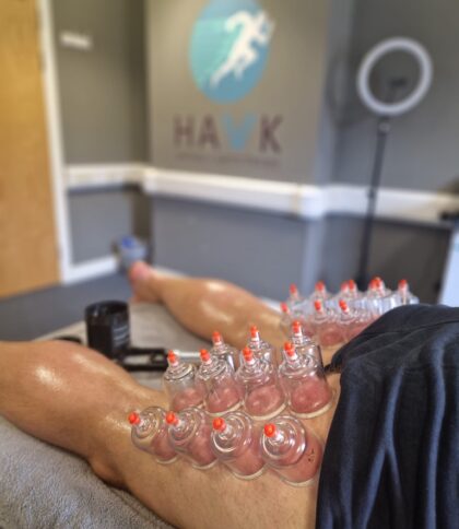 89E61B25-8DFA-403C-A868-6914FE079FA9_1_105_c